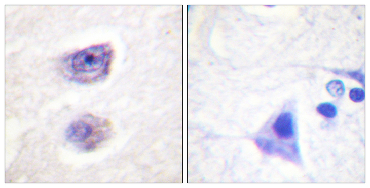 TH / Tyrosine Hydroxylase Antibody - Immunohistochemistry analysis of paraffin-embedded human brain, using Tyrosine Hydroxylase (Phospho-Ser8) Antibody. The picture on the right is blocked with the phospho peptide.