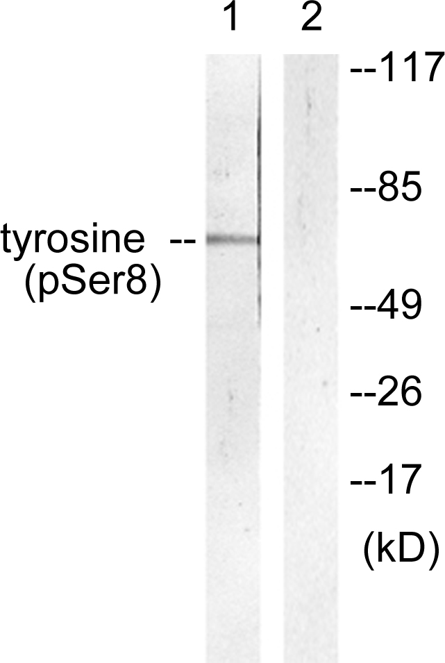 TH / Tyrosine Hydroxylase Antibody - Western blot analysis of lysates from HepG2 cells treated with Anisomycin 25ug/ml 30', using Tyrosine Hydroxylase (Phospho-Ser8) Antibody. The lane on the right is blocked with the phospho peptide.