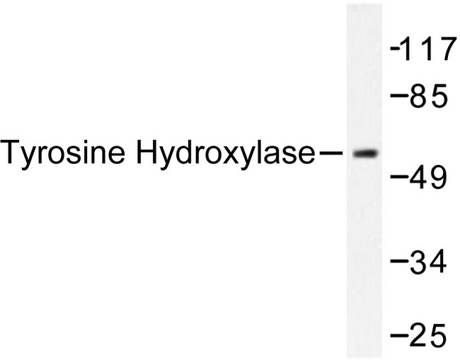 TH / Tyrosine Hydroxylase Antibody - Western blot of TH (P2) pAb in extracts from COLO205 cells treated with UV.