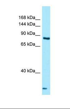 THADA Antibody - Western blot of Human MCF7. THADA antibody dilution 1.0 ug/ml.  This image was taken for the unconjugated form of this product. Other forms have not been tested.
