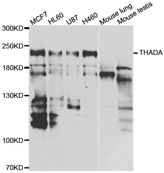THADA Antibody - Western blot analysis of extracts of various cell lines.