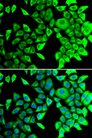 THADA Antibody - Immunofluorescence analysis of A549 cells.
