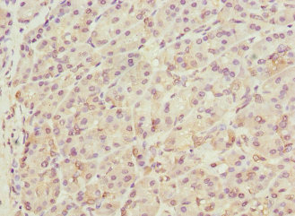 THADA Antibody - Immunohistochemistry of paraffin-embedded human pancreatic tissue at dilution 1:100
