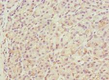 THADA Antibody - Immunohistochemistry of paraffin-embedded human pancreatic tissue at dilution 1:100