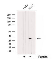 THAP2 Antibody - Western blot analysis of extracts of HeLa cells using THAP2 antibody. The lane on the left was treated with blocking peptide.