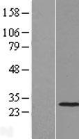 THAP2 Protein - Western validation with an anti-DDK antibody * L: Control HEK293 lysate R: Over-expression lysate