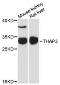 THAP3 Antibody - Western blot analysis of extracts of various cell lines, using THAP3 antibody at 1:3000 dilution. The secondary antibody used was an HRP Goat Anti-Rabbit IgG (H+L) at 1:10000 dilution. Lysates were loaded 25ug per lane and 3% nonfat dry milk in TBST was used for blocking. An ECL Kit was used for detection and the exposure time was 90s.