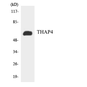THAP4 Antibody - Western blot analysis of the lysates from HT-29 cells using THAP4 antibody.
