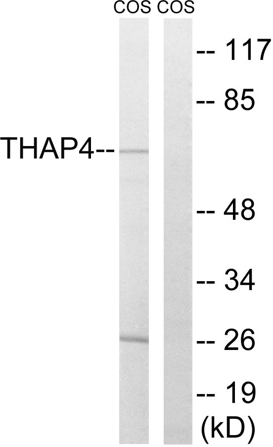 THAP4 Antibody - Western blot analysis of lysates from COS7 cells, using THAP4 Antibody. The lane on the right is blocked with the synthesized peptide.