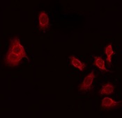 THAP4 Antibody - Staining HeLa cells by IF/ICC. The samples were fixed with PFA and permeabilized in 0.1% Triton X-100, then blocked in 10% serum for 45 min at 25°C. The primary antibody was diluted at 1:200 and incubated with the sample for 1 hour at 37°C. An Alexa Fluor 594 conjugated goat anti-rabbit IgG (H+L) Ab, diluted at 1/600, was used as the secondary antibody.