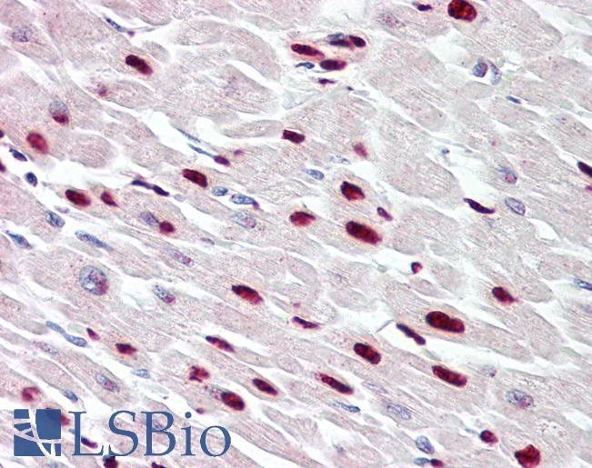 THAP5 Antibody - Anti-THAP5 antibody IHC of human heart. Immunohistochemistry of formalin-fixed, paraffin-embedded tissue after heat-induced antigen retrieval. Antibody dilution 5-7.5 ug/ml.  This image was taken for the unconjugated form of this product. Other forms have not been tested.