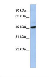 THAP5 Antibody - Placenta lysate. Antibody concentration: 1.0 ug/ml. Gel concentration: 12%.  This image was taken for the unconjugated form of this product. Other forms have not been tested.