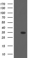 THAP6 Antibody - HEK293T cells were transfected with the pCMV6-ENTRY control (Left lane) or pCMV6-ENTRY THAP6 (Right lane) cDNA for 48 hrs and lysed. Equivalent amounts of cell lysates (5 ug per lane) were separated by SDS-PAGE and immunoblotted with anti-THAP6.