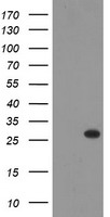 THAP6 Antibody - HEK293T cells were transfected with the pCMV6-ENTRY control (Left lane) or pCMV6-ENTRY THAP6 (Right lane) cDNA for 48 hrs and lysed. Equivalent amounts of cell lysates (5 ug per lane) were separated by SDS-PAGE and immunoblotted with anti-THAP6.