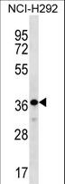 THAP8 Antibody - THAP8 Antibody western blot of NCI-H292 cell line lysates (35 ug/lane). The THAP8 antibody detected the THAP8 protein (arrow).
