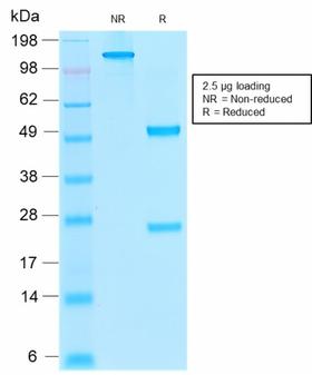 THBD / CD141 / Thrombomodulin Antibody - SDS-PAGE Analysis  Purified Thrombomodulin Mouse Recombinant MAb (rTHBD/1591). Confirmation of Purity and Integrity of Antibody.