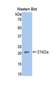 THBD / CD141 / Thrombomodulin Antibody - Western blot of recombinant THBD / CD141 / Thrombomodulin.  This image was taken for the unconjugated form of this product. Other forms have not been tested.