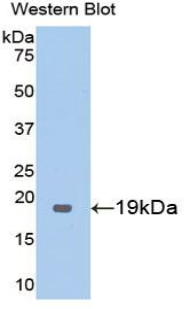 THBD / CD141 / Thrombomodulin Antibody - Western blot of recombinant THBD / CD141 / Thrombomodulin.  This image was taken for the unconjugated form of this product. Other forms have not been tested.