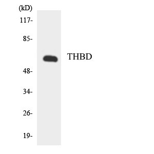 THBD / CD141 / Thrombomodulin Antibody - Western blot analysis of the lysates from HeLa cells using THBD antibody.