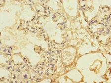 THBD / CD141 / Thrombomodulin Antibody - Immunohistochemistry of paraffin-embedded human lung tissue at dilution 1:100