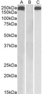 THBS1 / Thrombospondin-1 Antibody - THBS1 antibody HEK293 lysate (10 ug protein in RIPA buffer) overexpressing Human THBS1 with C-terminal MYC tag probed with (1 ug/ml) in Lane A and probed with anti-MYC Tag (1/1000) in lane C. Mock-transfected HEK293 probed with (1 ug/ml) in Lane B. Primary incubations were for 1 hour. Detected by chemiluminescence.