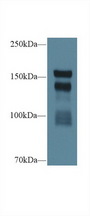 THBS1 / Thrombospondin-1 Antibody - Western Blot; Sample: Rat Serum; Primary Ab: 1µg/ml Rabbit Anti-Rat THBS1 Antibody Second Ab: 0.2µg/mL HRP-Linked Caprine Anti-Rabbit IgG Polyclonal Antibody