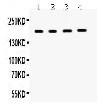 THBS1 / Thrombospondin-1 Antibody - THBS1 antibody Western blot. All lanes: Anti THBS1 at 0.5 ug/ml. Lane 1: Human Placenta Tissue Lysate at 50 ug. Lane 2: HELA Whole Cell Lysate at 40 ug. Lane 3: A431 Whole Cell Lysate at 40 ug. Lane 4: MCF-7 Whole Cell Lysate at 40 ug. Predicted band size: 130 kD. Observed band size: 190 kD.