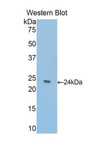 THBS1 / Thrombospondin-1 Antibody - Western blot of recombinant THBS1 / Thrombospondin-1.  This image was taken for the unconjugated form of this product. Other forms have not been tested.