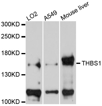 THBS1 / Thrombospondin-1 Antibody - Western blot analysis of extracts of various cells.