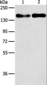 THBS1 / Thrombospondin-1 Antibody - Western blot analysis of A431 and Huvec cell, using THBS1 Polyclonal Antibody at dilution of 1:250.