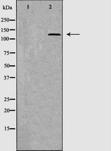 THBS1 / Thrombospondin-1 Antibody - Western blot analysis of extracts of HepG2 cells using THBS1 antibody. The lane on the left is treated with the antigen-specific peptide.