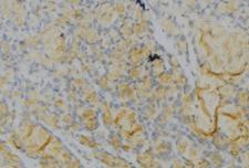 THBS1 / Thrombospondin-1 Antibody - 1:100 staining human gastric tissue by IHC-P. The sample was formaldehyde fixed and a heat mediated antigen retrieval step in citrate buffer was performed. The sample was then blocked and incubated with the antibody for 1.5 hours at 22°C. An HRP conjugated goat anti-rabbit antibody was used as the secondary.
