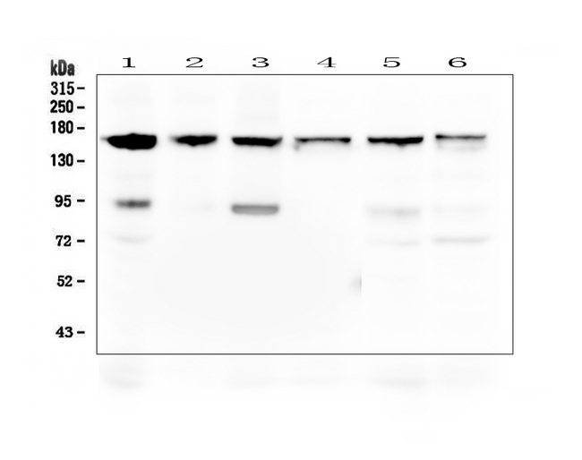 THBS2 / Thrombospondin 2 Antibody - Western blot analysis of Thrombospondin 2/THBS2 using anti-Thrombospondin 2/THBS2 antibody. Electrophoresis was performed on a 5-20% SDS-PAGE gel at 70V (Stacking gel) / 90V (Resolving gel) for 2-3 hours. The sample well of each lane was loaded with 50ug of sample under reducing conditions. Lane 1: human Hela whole cell lysates, Lane 2: human 22RV1 whole cell lysates, Lane 3: human U-87MG whole cell lysates, Lane 4: human THP-1 whole cell lysates, Lane 5: human PC-3 whole cell lysates, Lane 6: human Caco-2 whole cell lysates. After Electrophoresis, proteins were transferred to a Nitrocellulose membrane at 150mA for 50-90 minutes. Blocked the membrane with 5% Non-fat Milk/ TBS for 1.5 hour at RT. The membrane was incubated with rabbit anti-Thrombospondin 2/THBS2 antigen affinity purified polyclonal antibody at 0.5 µg/mL overnight at 4°C, then washed with TBS-0.1% Tween 3 times with 5 minutes each and probed with a goat anti-rabbit IgG-HRP secondary antibody at a dilution of 1:10000 for 1.5 hour at RT. The signal is developed using an Enhanced Chemiluminescent detection (ECL) kit with Tanon 5200 system. A specific band was detected for Thrombospondin 2/THBS2 at approximately 160-190KD. The expected band size for Thrombospondin 2/THBS2 is at 130KD.