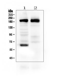 THBS2 / Thrombospondin 2 Antibody - Western blot analysis of Thrombospondin 2/THBS2 using anti-Thrombospondin 2/THBS2 antibody. Electrophoresis was performed on a 5-20% SDS-PAGE gel at 70V (Stacking gel) / 90V (Resolving gel) for 2-3 hours. The sample well of each lane was loaded with 50ug of sample under reducing conditions. Lane 1: rat brain tissue lysates, Lane 2: mouse brain tissue lysates. After Electrophoresis, proteins were transferred to a Nitrocellulose membrane at 150mA for 50-90 minutes. Blocked the membrane with 5% Non-fat Milk/ TBS for 1.5 hour at RT. The membrane was incubated with rabbit anti-Thrombospondin 2/THBS2 antigen affinity purified polyclonal antibody at 0.5 µg/mL overnight at 4°C, then washed with TBS-0.1% Tween 3 times with 5 minutes each and probed with a goat anti-rabbit IgG-HRP secondary antibody at a dilution of 1:10000 for 1.5 hour at RT. The signal is developed using an Enhanced Chemiluminescent detection (ECL) kit with Tanon 5200 system. A specific band was detected for Thrombospondin 2/THBS2 at approximately 160-190KD. The expected band size for Thrombospondin 2/THBS2 is at 130KD.