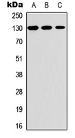 THBS2 / Thrombospondin 2 Antibody - Western blot analysis of Thrombospondin 2 expression in A549 (A); Raw264.7 (B); PC12 (C) whole cell lysates.