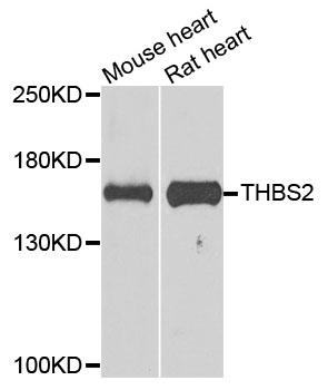 THBS2 / Thrombospondin 2 Antibody - Western blot analysis of extracts of various cells.