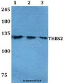 THBS2 / Thrombospondin 2 Antibody - Western blot of THBS2 antibody at 1:500 dilution. Lane 1: A549 whole cell lysate. Lane 2: Raw264.7 whole cell lysate. Lane 3: PC12 whole cell lysate.
