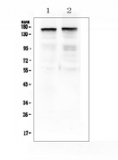 THBS2 / Thrombospondin 2 Antibody - Western blot analysis of Thrombospondin 2 using anti-Thrombospondin 2 antibody. Electrophoresis was performed on a 5-20% SDS-PAGE gel at 70V (Stacking gel) / 90V (Resolving gel) for 2-3 hours. The sample well of each lane was loaded with 50ug of sample under reducing conditions. Lane 1: rat brain tissue lysates, Lane 2: mouse brain tissue lysates. After Electrophoresis, proteins were transferred to a Nitrocellulose membrane at 150mA for 50-90 minutes. Blocked the membrane with 5% Non-fat Milk/ TBS for 1.5 hour at RT. The membrane was incubated with rabbit anti-Thrombospondin 2 antigen affinity purified polyclonal antibody at 0.5 ?g/mL overnight at 4?C, then washed with TBS-0.1% Tween 3 times with 5 minutes each and probed with a goat anti-rabbit IgG-HRP secondary antibody at a dilution of 1:10000 for 1.5 hour at RT. The signal is developed using an Enhanced Chemiluminescent detection (ECL) kit with Tanon 5200 system. A specific band was detected for Thrombospondin 2 at approximately 160KD. The expected band size for Thrombospondin 2 is at 130KD.