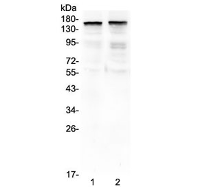 THBS2 / Thrombospondin 2 Antibody - Western blot testing of 1) rat brain and 2) mouse brain lysate with THBS2 antibody at 0.5ug/ml. Expected molecular weight: 130-170 kDa depending on glycosylation level.