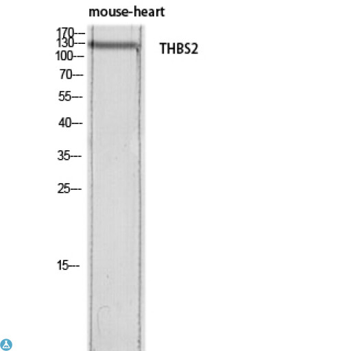 THBS2 / Thrombospondin 2 Antibody - Western Blot (WB) analysis of Mouse Heart lysis using THBS2 antibody.