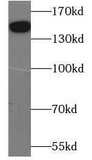 THBS2 / Thrombospondin 2 Antibody - Mouse heart were subjected to SDS PAGE followed by western blot with THBS21 antibody at dilution of 1:1000