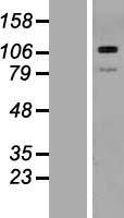 THBS3 / Thrombospondin 3 Protein - Western validation with an anti-DDK antibody * L: Control HEK293 lysate R: Over-expression lysate