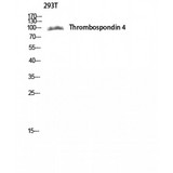 THBS4 / Thrombospondin 4 Antibody - Western blot of Thrombospondin 4 antibody