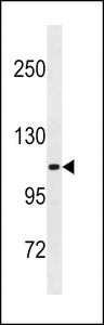 THBS4 / Thrombospondin 4 Antibody - THBS4 Antibody western blot of NCI-H460 cell line lysates (35 ug/lane). The THBS4 antibody detected the THBS4 protein (arrow).