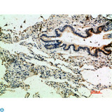 THBS4 / Thrombospondin 4 Antibody - Immunohistochemical analysis of paraffin-embedded human-lung, antibody was diluted at 1:200.