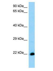THEM6 / C8orf55 Antibody - THEM6 / C8orf55 antibody Western Blot of Mouse Stomach. Antibody dilution: 1 ug/ml.  This image was taken for the unconjugated form of this product. Other forms have not been tested.
