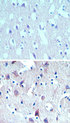 THEM6 / C8orf55 Antibody - IHC of DSCD75 in paraffin-embedded formalin-fixed human brain tissue using an isotype control (top) and Peptide-affinity Purified Polyclonal Antibody to Mesenchymal stem cell protein DSCD75 (bottom) at 5 ug/ml.