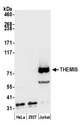 THEMIS / SPOT Antibody - Detection of human THEMIS by western blot. Samples: Whole cell lysate (50 µg) from HeLa, HEK293T, and Jurkat cells prepared using NETN lysis buffer. Antibody: Affinity purified rabbit anti-THEMIS antibody used for WB at 0.1 µg/ml. Detection: Chemiluminescence with an exposure time of 10 seconds.