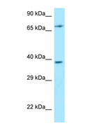 THEMIS / SPOT Antibody - THEMIS antibody Western blot of Jurkat Cell lysate. Antibody concentration 1 ug/ml.  This image was taken for the unconjugated form of this product. Other forms have not been tested.