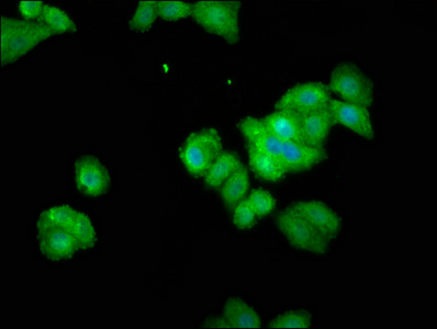 THEMIS / SPOT Antibody - Immunofluorescence staining of HepG2 cells at a dilution of 1:100, counter-stained with DAPI. The cells were fixed in 4% formaldehyde, permeabilized using 0.2% Triton X-100 and blocked in 10% normal Goat Serum. The cells were then incubated with the antibody overnight at 4 °C.The secondary antibody was Alexa Fluor 488-congugated AffiniPure Goat Anti-Rabbit IgG (H+L) .